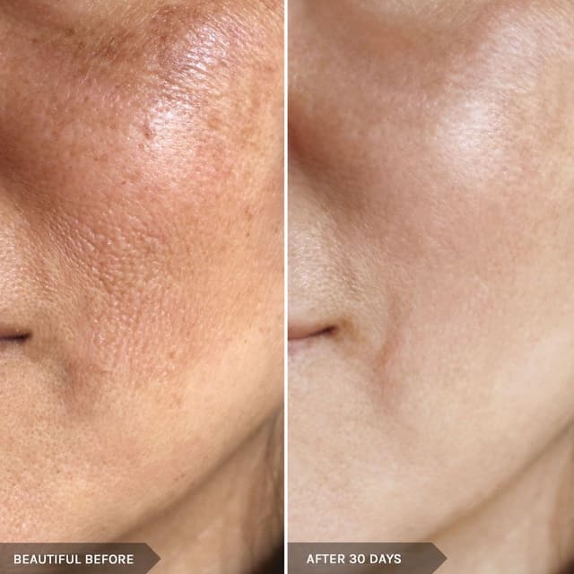 LUMECCA PEAK FACIAL at Lavana by Remake in Edinburg, TX
